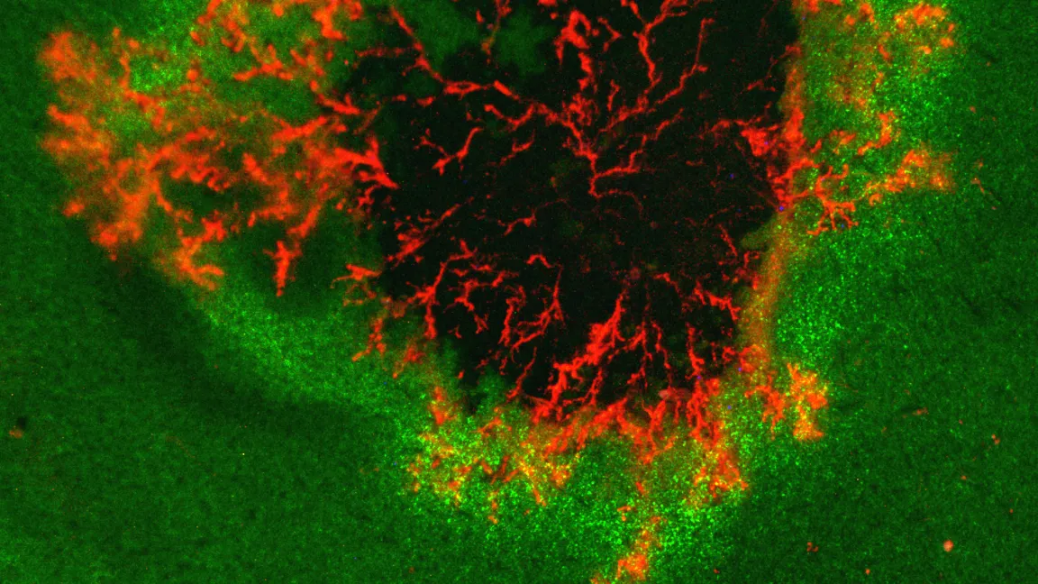 Infektionsstelle des Erregers Phytophthora infestans auf einem Blatt. Die sich ausbreitenden Erregerhyphen sind rot-fluoreszierend markiert. Lebendes Blattgewebe ist grün, abgestorbenes Gewebe ist dunkel. Foto: Sebastian Schornack/Sainsbury Laboratory