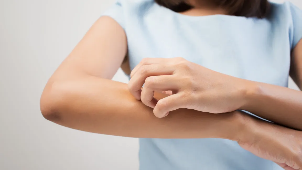 Auch bei verschiedenen Hauterkrankungen hilft Hafer. Foto: Fotolia