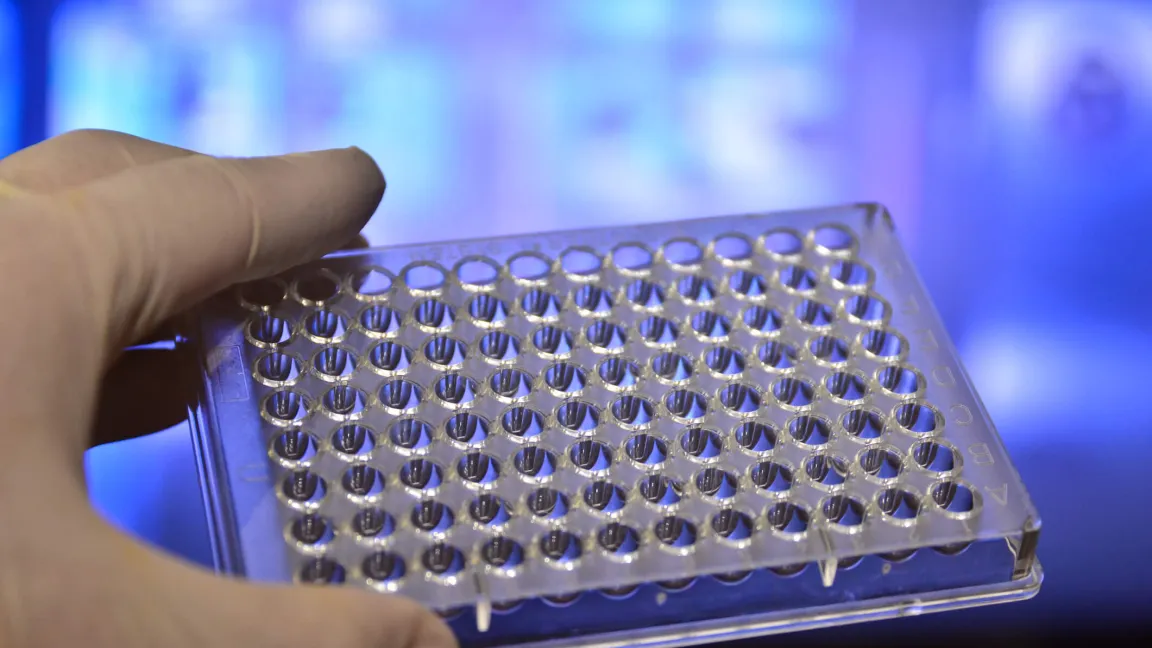 Das Problem unterschiedlich schnell wachsender Kulturen kann umgangen werden, wenn die Mikroorganismen geschickt verdünnt und in Flüssigmedien in 96-Loch-Kulturplatten kultiviert werden. Foto: iStock