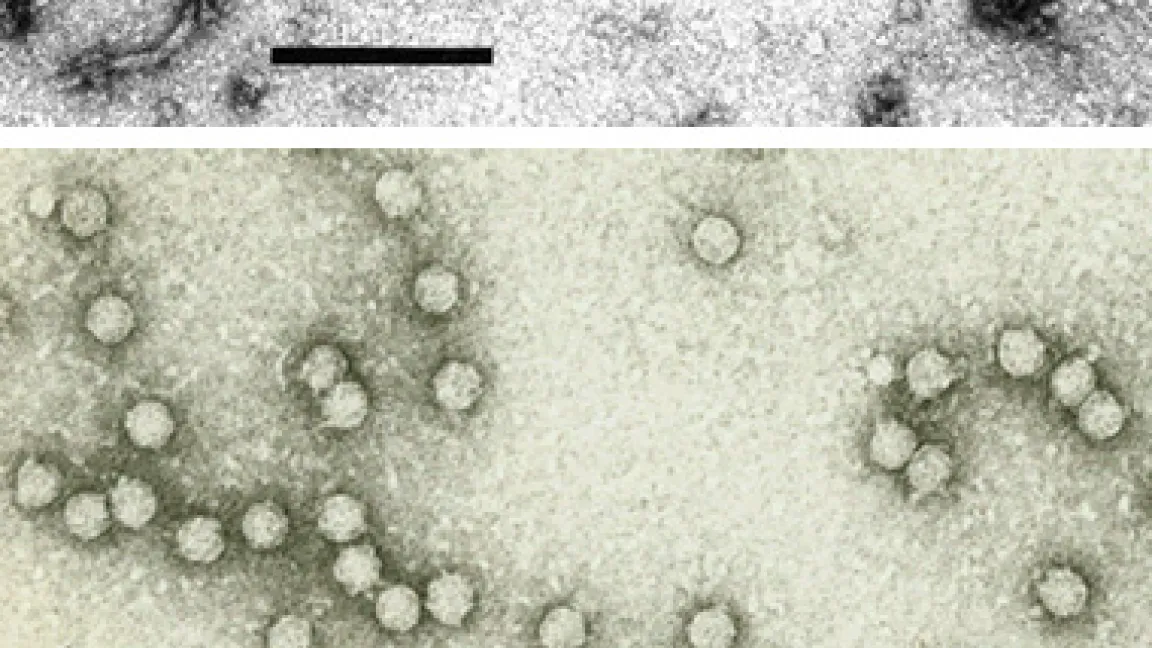 Fadenförmige und kugelförmige Partikel von Viren, die Möhren und Petersilie infizieren. Einerseits ein fadenförmiges Partikel des Carrot yellow leaf virus (CYLV), andererseits zahlreiche kugelförmige (isometrische) Partikel des Carrot red leaf virus (CtRLV) aus der Gattung Polerovirus der Familie Luteoviridae.
Quelle: H.Josef Vetten, BBA