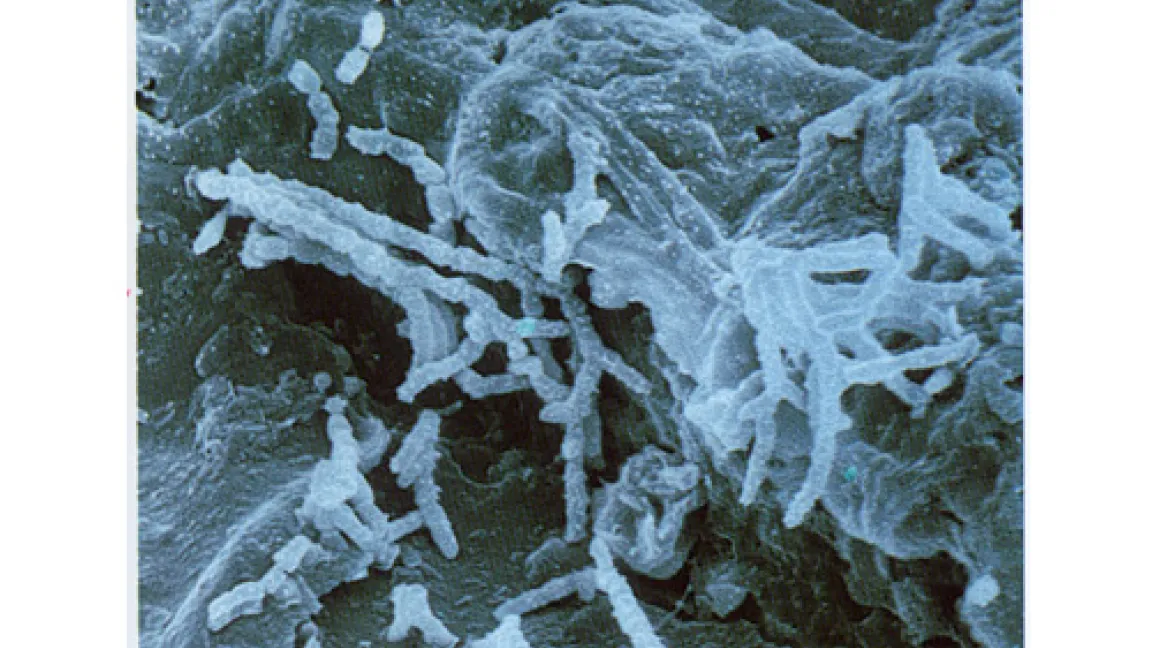 Typische Bodenbakterien im Humus
	Quelle: Manfred Kage, Lauterstein.