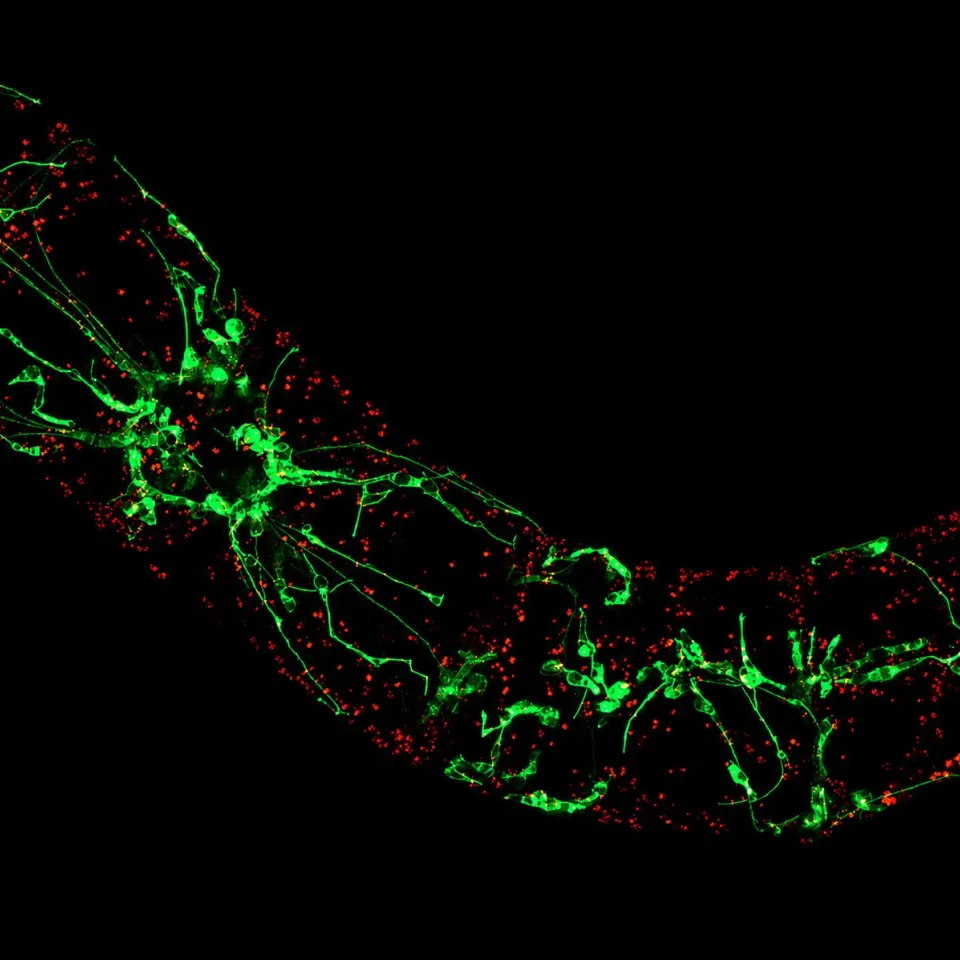 <p>Pflanzen zeigen der Hitze den „Finger“: Geraten Pflanzen durch hohe Temperaturen oder Trockenheit in Stress, bilden sich im Innern der Zellen Ausstülpungen, die Schutzprogramme auslösen.</p>