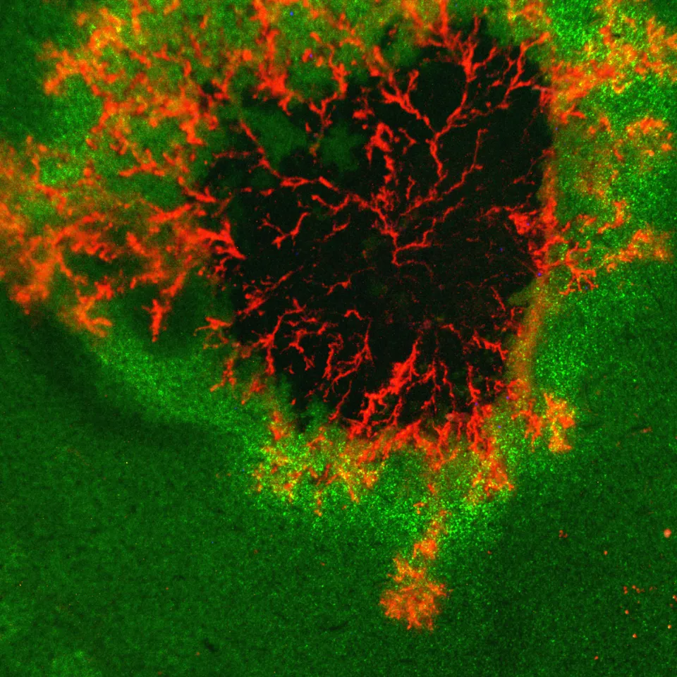 Phytophthora: Kartoffeln mit den richtigen Antennen