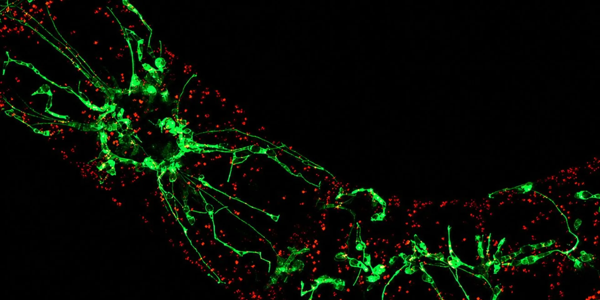 <p>Pflanzen zeigen der Hitze den „Finger“: Geraten Pflanzen durch hohe Temperaturen oder Trockenheit in Stress, bilden sich im Innern der Zellen Ausstülpungen, die Schutzprogramme auslösen.</p>